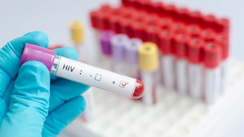Moçambique – Autoridades reforçam testagem para reduzir prevalência de HIV em Maputo
