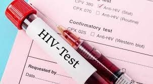 Guiné-Bissau – Casos de VIH estão a aumentar no país, alerta o diretor do Hospital de Cumura