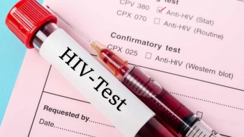 Moçambique pode perder fundos de combate ao HIV-SIDA provenientes dos EUA 