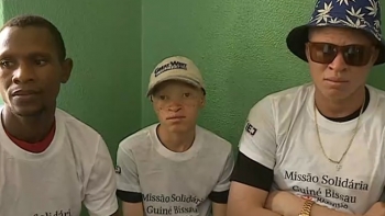 Guiné-Bissau – Tem crescido o número de abandono escolar por pessoas com albinismo