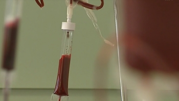 Cabo Verde registou até agora 31 casos de hemofilia