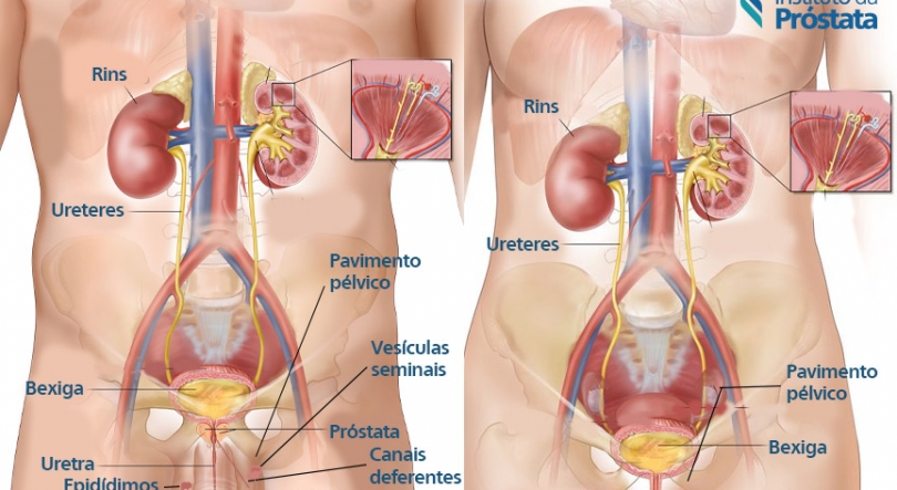 Imagem de Viva Saúde – Doenças Urológicas