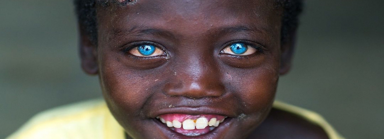 Imagem de África Visão