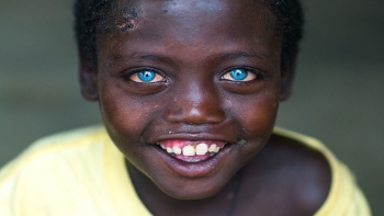 Imagem de África Visão