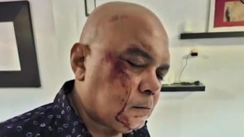 Imagem de Guiné-Bissau – Delegado da RTP agredido “por motivações políticas”