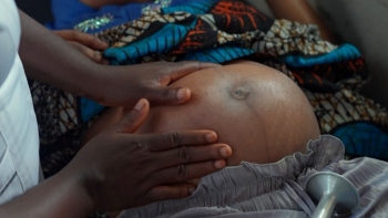 Imagem de Guiné-Bissau tem das taxas de mortalidade infantil mais elevadas do mundo
